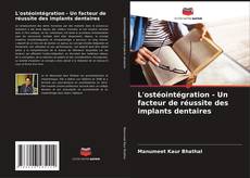 Обложка L'ostéointégration - Un facteur de réussite des implants dentaires