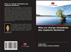 Bookcover of Mise en charge immédiate des implants dentaires