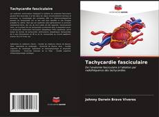 Tachycardie fasciculaire kitap kapağı