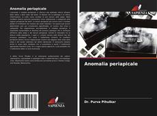 Bookcover of Anomalia periapicale