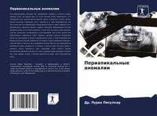 Capa do livro de Периапикальные аномалии 