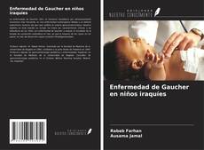 Bookcover of Enfermedad de Gaucher en niños iraquíes