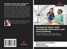 Buchcover von Periapical lesion with retrograde obturation and bone grafting