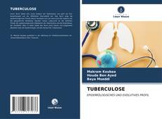 Bookcover of TUBERCULOSE