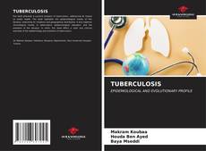 TUBERCULOSIS kitap kapağı