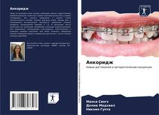 Bookcover of Анкоридж