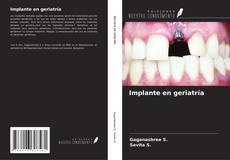 Buchcover von Implante en geriatría