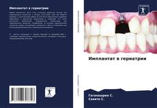 Bookcover of Имплантат в гериатрии
