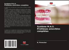 Buchcover von Système M.A.S. Prothèses amovibles complètes