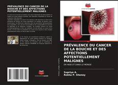Copertina di PRÉVALENCE DU CANCER DE LA BOUCHE ET DES AFFECTIONS POTENTIELLEMENT MALIGNES