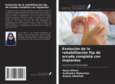 Copertina di Evolución de la rehabilitación fija de arcada completa con implantes