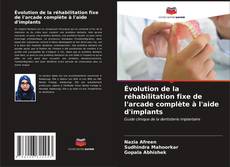 Bookcover of Évolution de la réhabilitation fixe de l'arcade complète à l'aide d'implants