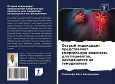 Bookcover of Острый эндокардит представляет смертельную опасность для пациентов, находящихся на гемодиализе