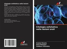 Bookcover of Citologia esfoliativa nelle lesioni orali
