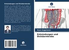 Capa do livro de Entzündungen und Dickdarmkrebs 