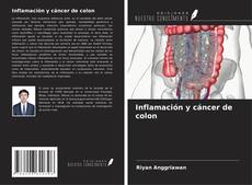 Buchcover von Inflamación y cáncer de colon