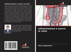 Capa do livro de Infiammazione e cancro al colon 