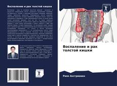 Buchcover von Воспаление и рак толстой кишки