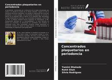 Bookcover of Concentrados plaquetarios en periodoncia