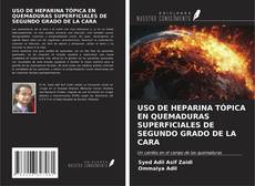 USO DE HEPARINA TÓPICA EN QUEMADURAS SUPERFICIALES DE SEGUNDO GRADO DE LA CARA kitap kapağı