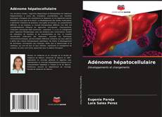 Buchcover von Adénome hépatocellulaire