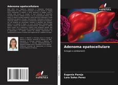Bookcover of Adenoma epatocellulare