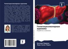 Bookcover of Гепатоцеллюлярная аденома