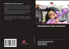 Обложка Dentisterie mini-invasive