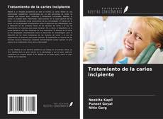 Bookcover of Tratamiento de la caries incipiente