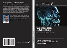 Bookcover of Superposición cefalométrica