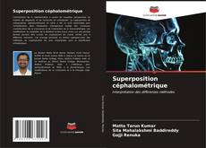 Superposition céphalométrique kitap kapağı