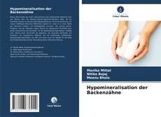 Bookcover of Hypomineralisation der Backenzähne