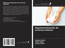 Buchcover von Hipomineralización de incisivos molares