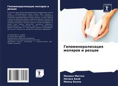 Portada del libro de Гипоминерализация моляров и резцов