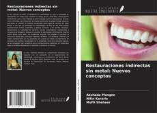 Buchcover von Restauraciones indirectas sin metal: Nuevos conceptos