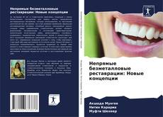 Portada del libro de Непрямые безметалловые реставрации: Новые концепции