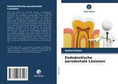 Bookcover of Endodontische parodontale Läsionen