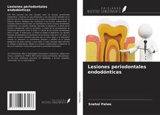 Bookcover of Lesiones periodontales endodónticas