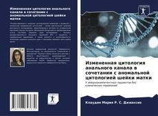 Portada del libro de Измененная цитология анального канала в сочетании с аномальной цитологией шейки матки