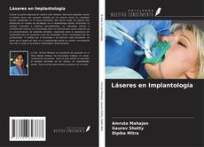 Capa do livro de Láseres en Implantología 