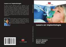 Copertina di Lasers en implantologie