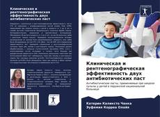 Bookcover of Клиническая и рентгенографическая эффективность двух антибиотических паст