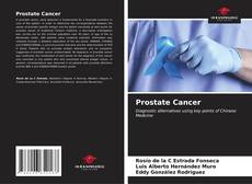 Bookcover of Prostate Cancer