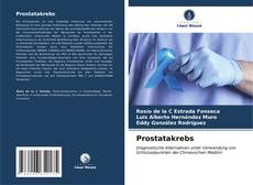 Capa do livro de Prostatakrebs 