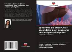 Couverture de Syndrome de Budd Chiari secondaire à un syndrome des antiphospholipides