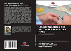 Bookcover of LES DÉFAILLANCES DES PROTHÈSES PARTIELLES FIXES