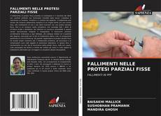 Bookcover of FALLIMENTI NELLE PROTESI PARZIALI FISSE