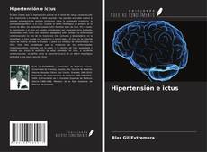 Hipertensión e ictus的封面