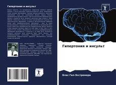 Capa do livro de Гипертония и инсульт 