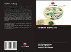 Capa do livro de Biofilm dentaire 
